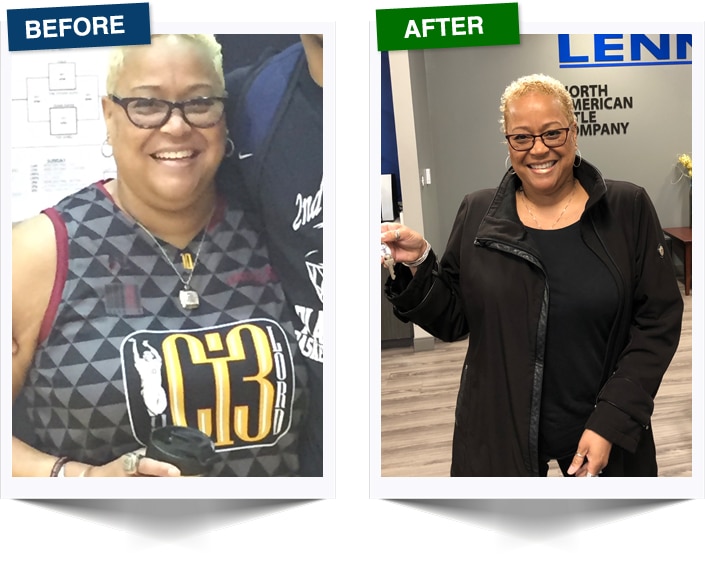 Weight Loss Before and After 1